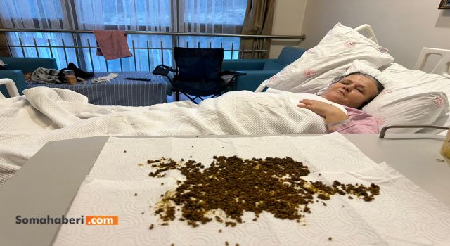20 BİN TAŞLIK MUCİZE! Soma'da Yaşlı Kadın, Türkiye'de Nadir Görülen Operasyonla Sağlığına Kavuştu.