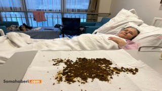 20 BİN TAŞLIK MUCİZE! Soma'da Yaşlı Kadın, Türkiye'de Nadir Görülen Operasyonla Sağlığına Kavuştu.