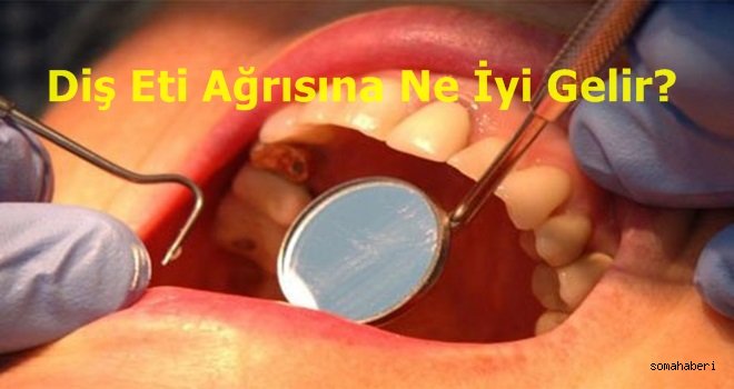 Diş Eti Ağrısına Ne İyi Geliyor